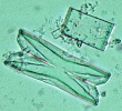 Struvite crystals