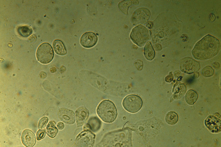 epithelial cells sediment transitional epithelium urinary tract